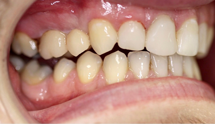 After - FP Dental