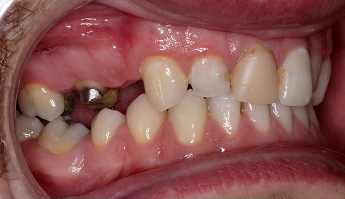 Before - FP Dental