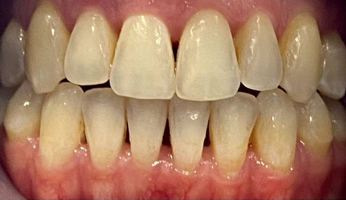 After - FP Dental