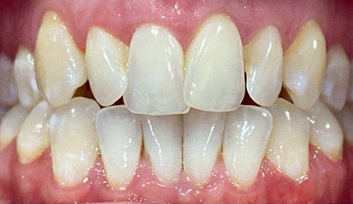 Before - FP Dental