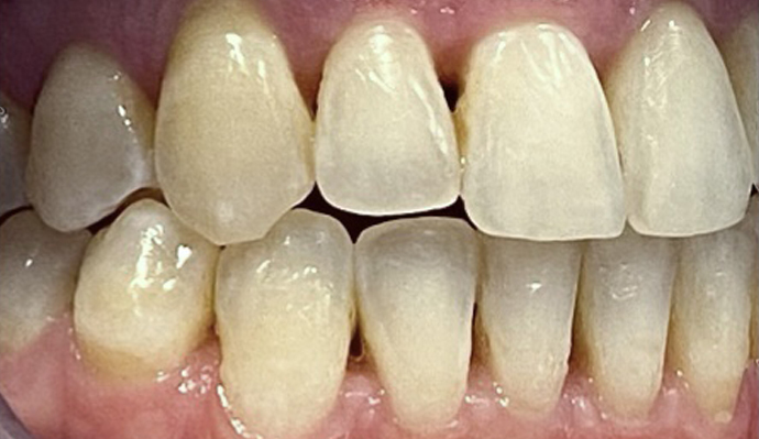 After - FP Dental