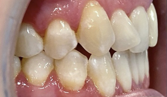 Before - FP Dental