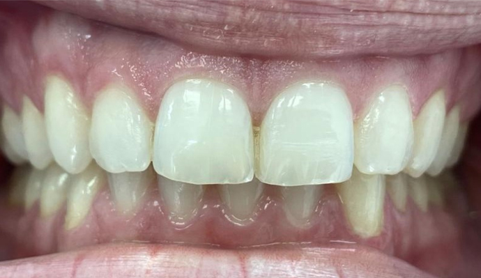 After - FP Dental