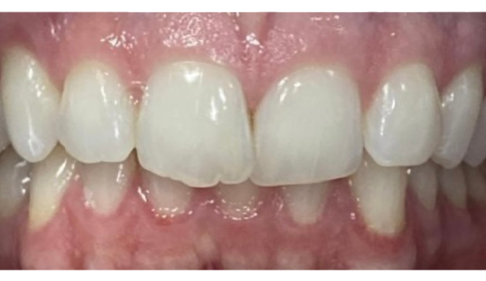 Before - FP Dental
