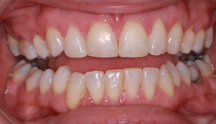 After - FP Dental