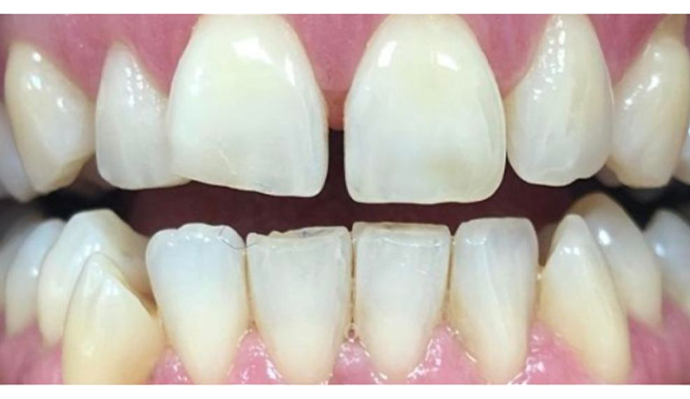 Before - FP Dental