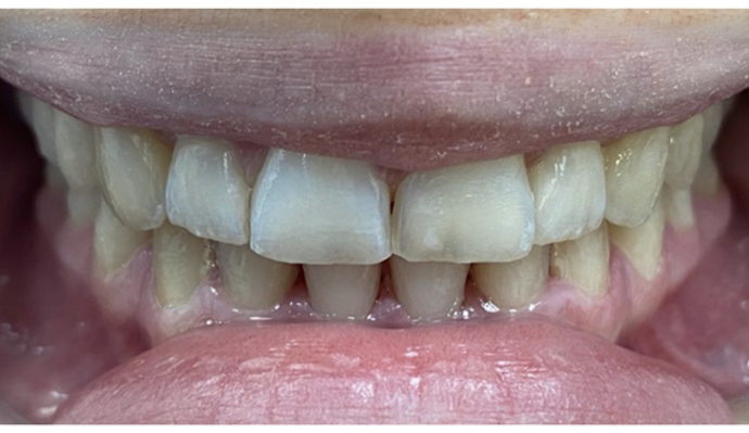 After - FP Dental