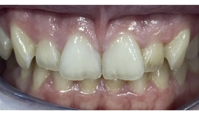 Before - FP Dental