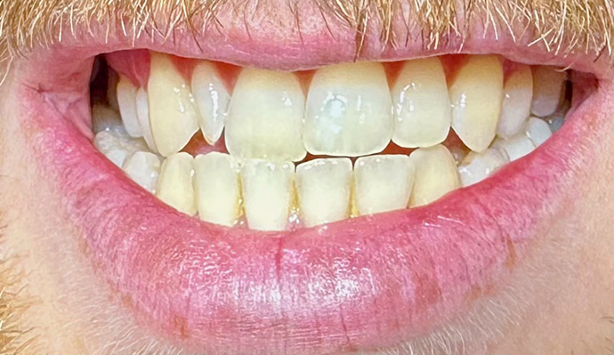 Before - FP Dental