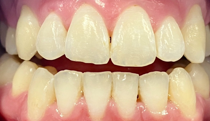 After - FP Dental