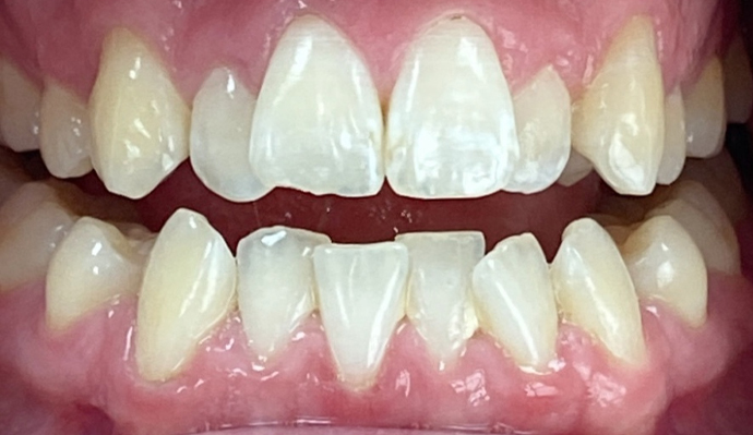 Before - FP Dental