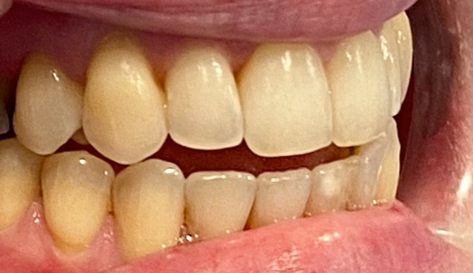 After - FP Dental