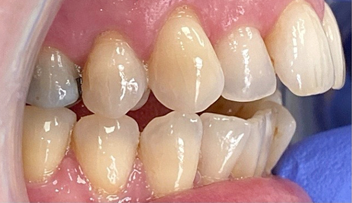 Before - FP Dental