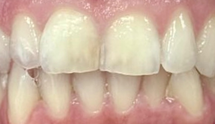 Before - FP Dental