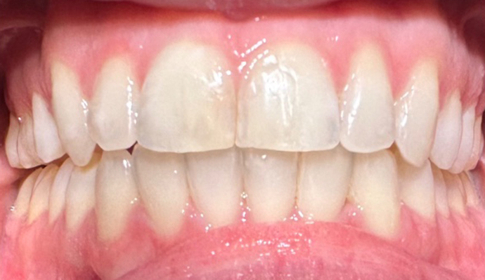 After - FP Dental