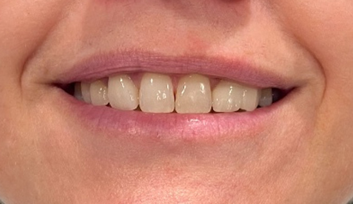 After - FP Dental