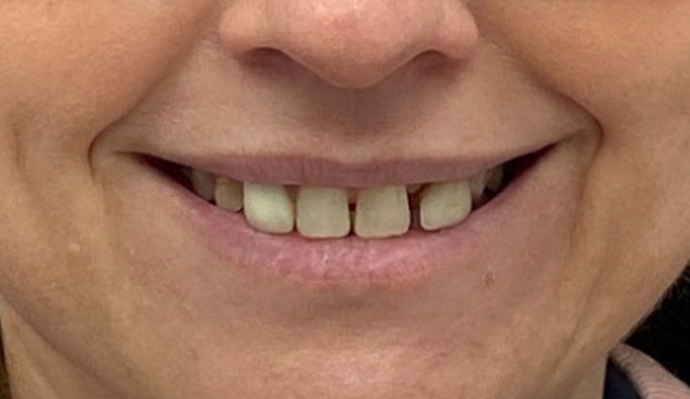 Before - FP Dental