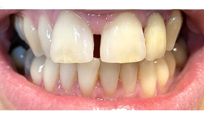 After - FP Dental