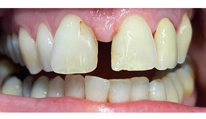 Before - FP Dental
