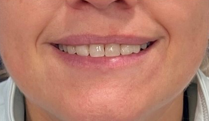 After - FP Dental