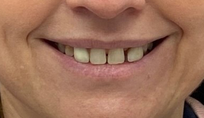 Before - FP Dental