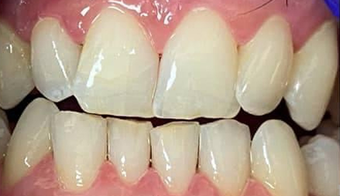 After - FP Dental