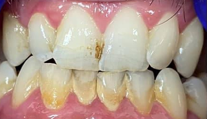 Before - FP Dental