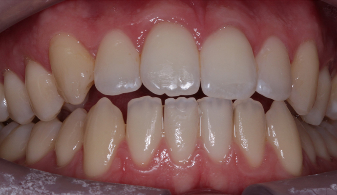 After - FP Dental
