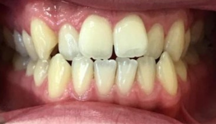 Before - FP Dental