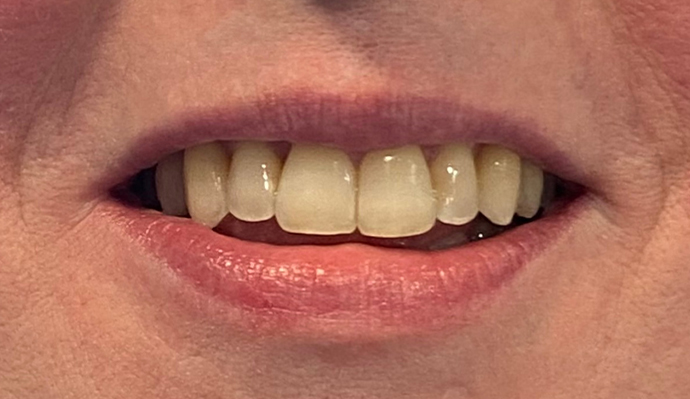 After - FP Dental