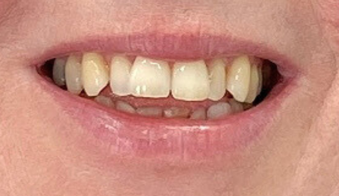 Before - FP Dental