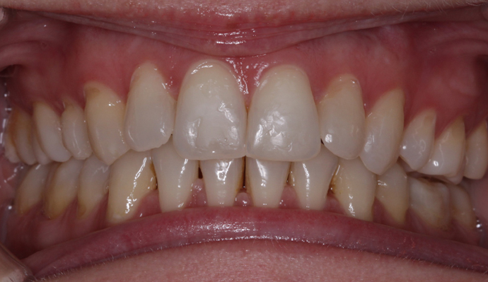 After - FP Dental