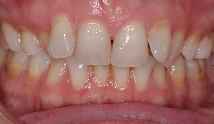 Before - FP Dental