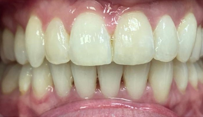 After - FP Dental