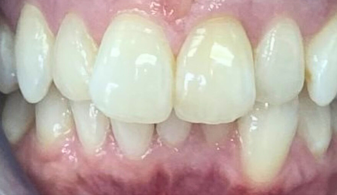 Before - FP Dental